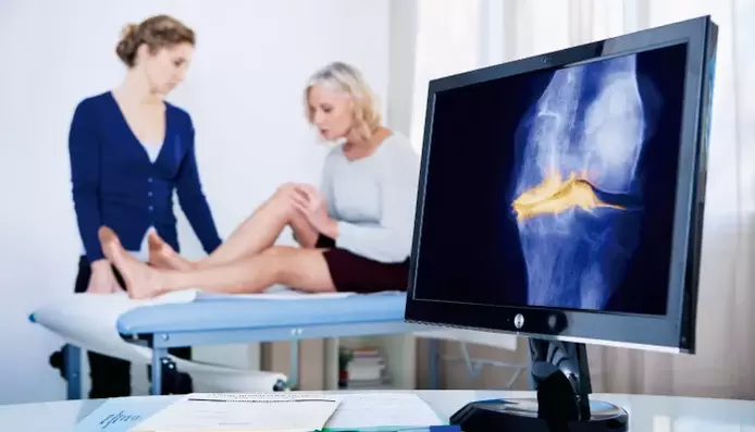 artróza kĺbu u ženy